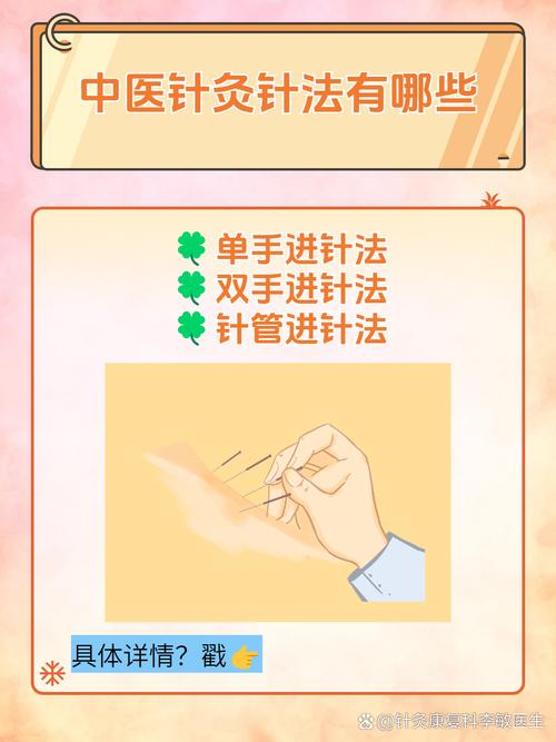 胡光针灸特色与针法