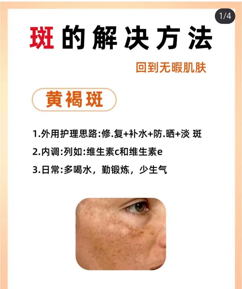 怎样袪斑最有效最安全