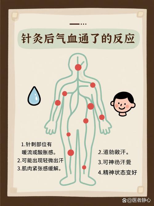 气血不通针灸好不好