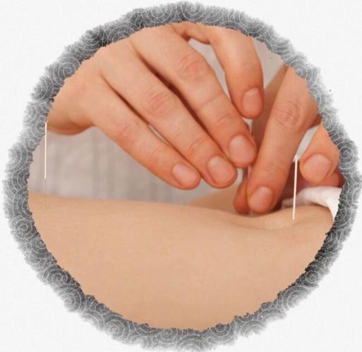 扬州中医院针灸推拿