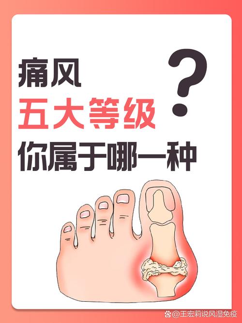 痛风分为哪几种类型