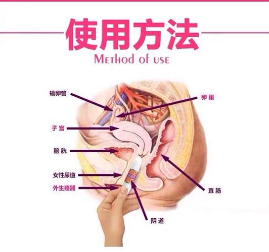 缩阴产品哪个安全有效