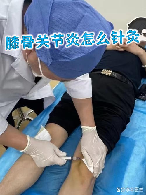 针灸能治韧带损伤吗