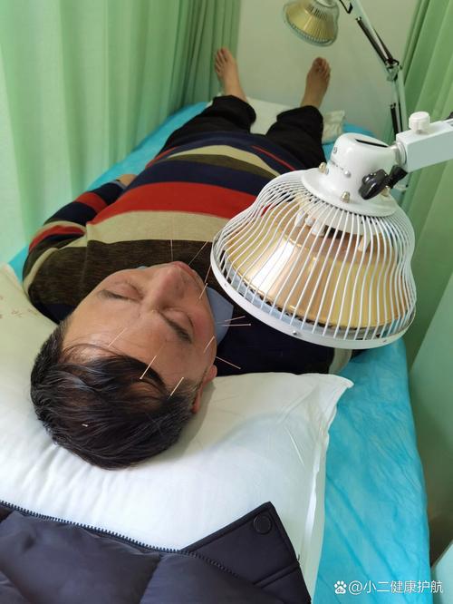 听神经瘤术面瘫针灸