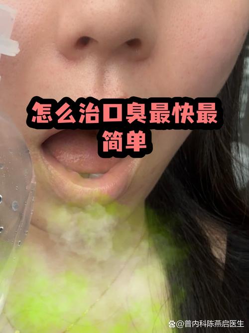 长沙治口臭问胃康安全