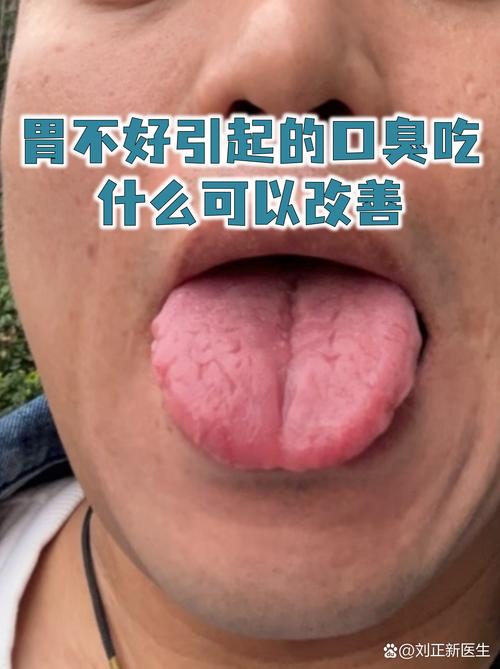 长沙治口臭问胃康安全