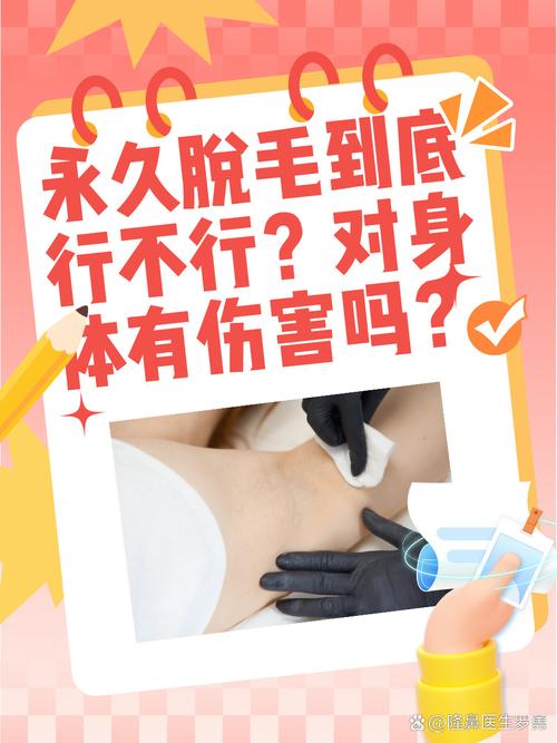 激光脱毛上海美莱安全