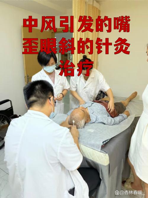 神经性眼部针灸好吗