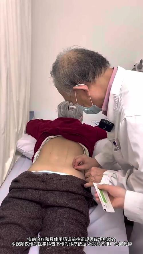 保定针灸治疗腰椎病