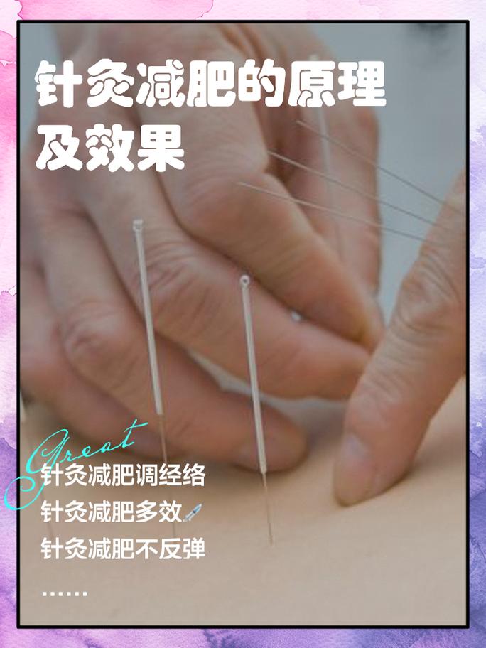 来月经能针灸减肥吗