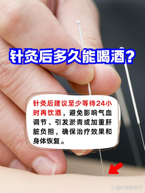针灸后可以喝啤酒吗