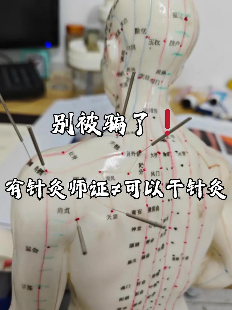 中医学考试重点针灸