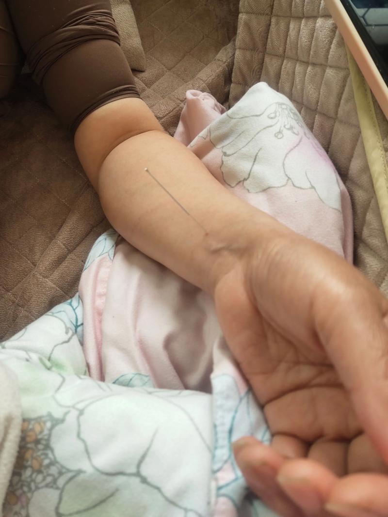 针灸治好了我的脾虚