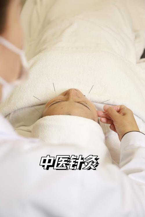 上海去哪学专业针灸