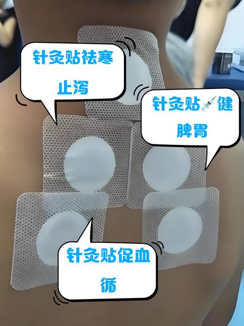 针灸贴祛眼袋烧痛感