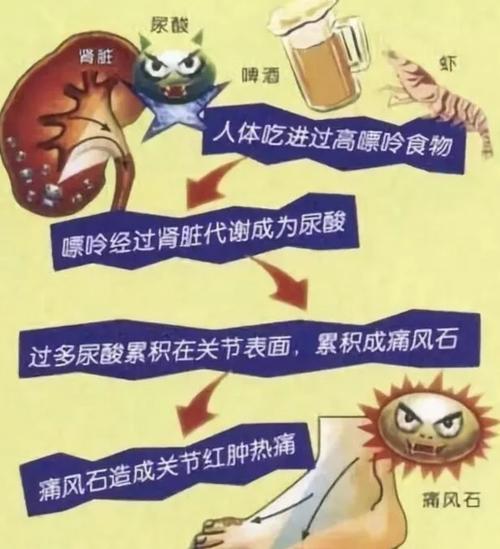 为什么痛风反反复复