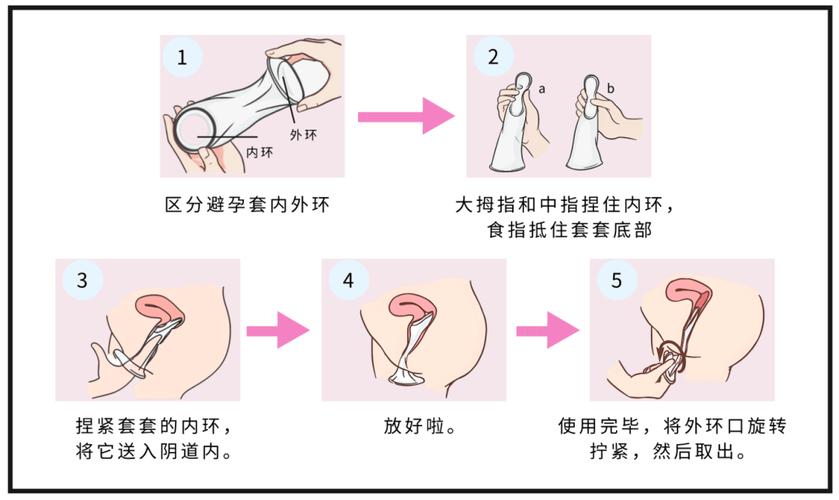 怎么做好避孕安全措施