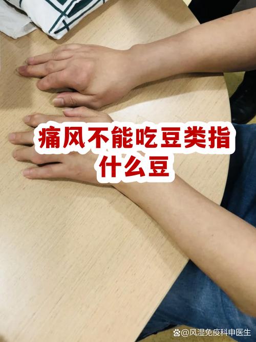 痛风病人能吃豆腐么