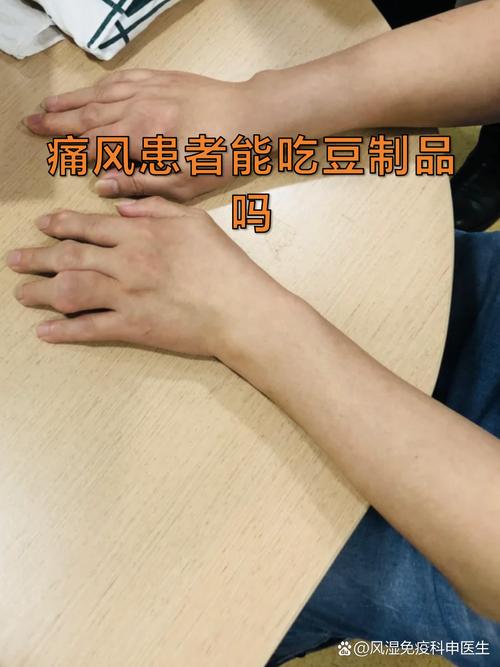 痛风病人不能吃豆腐