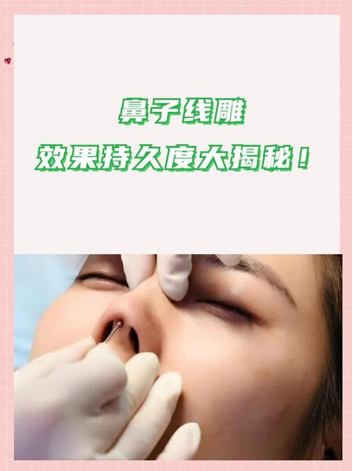 线雕隆鼻上海美莱安全