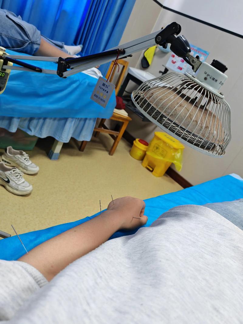 抚顺矿务局针灸减肥