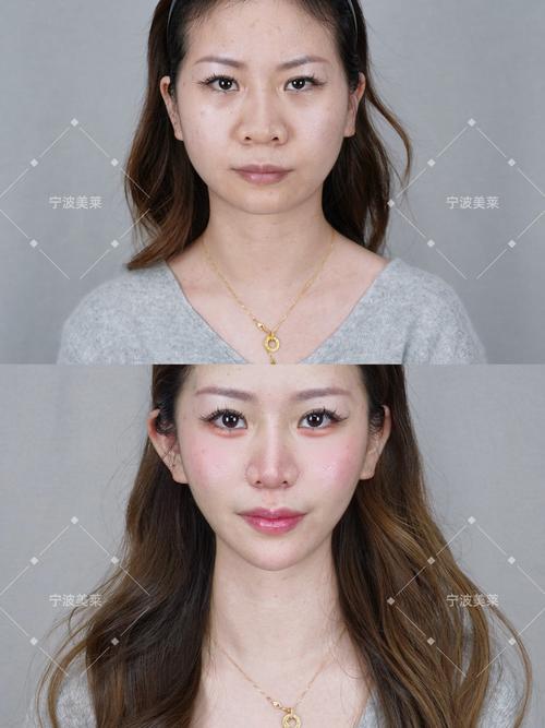 宁波美白宁波美莱安全