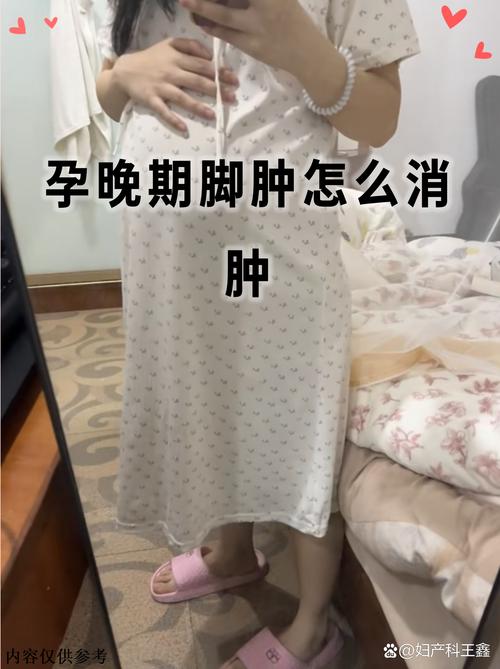 怀孕痛风脚肿怎么办