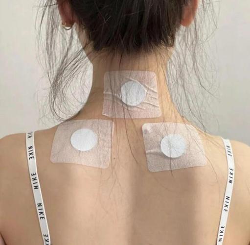 瘦针灸瘦手臂怎么贴