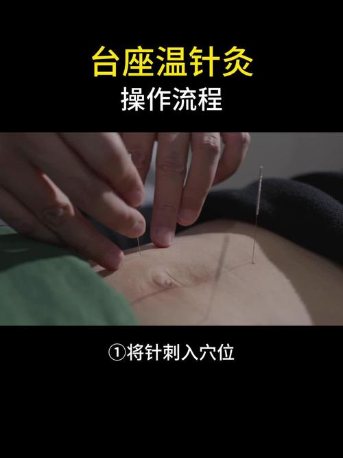 针灸学免费教学视频