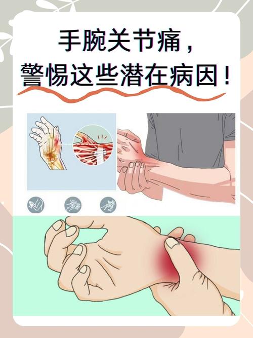 手腕关节疼是痛风吗