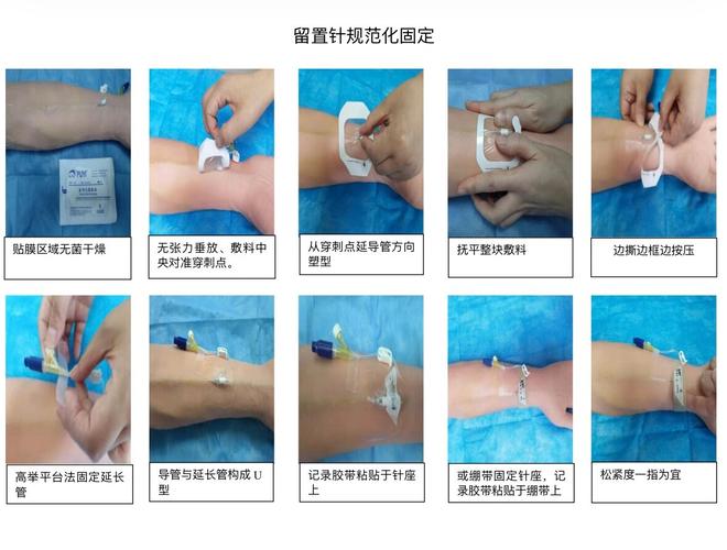 安全型留置针操作视频