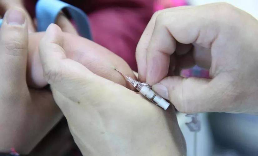 安全型留置针操作视频