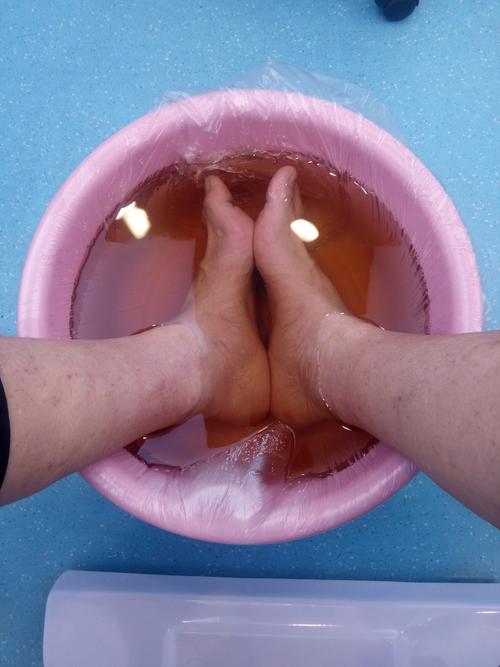 痛风石能热水泡脚吗