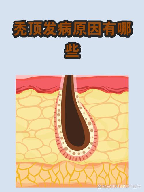 哈尔滨脱发医学会安全