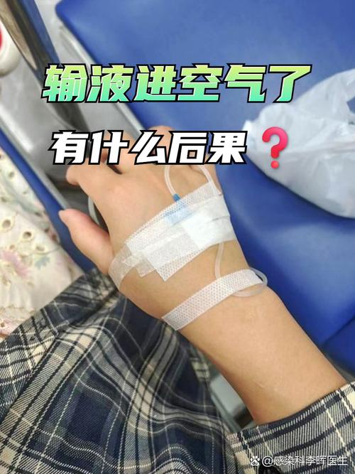 输液进空气后多久安全