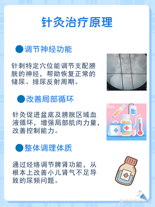 尿频尿急可以针灸吗