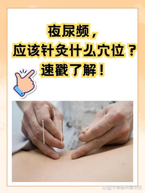 尿频尿急可以针灸吗