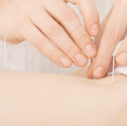 沈阳朱医生针灸减肥