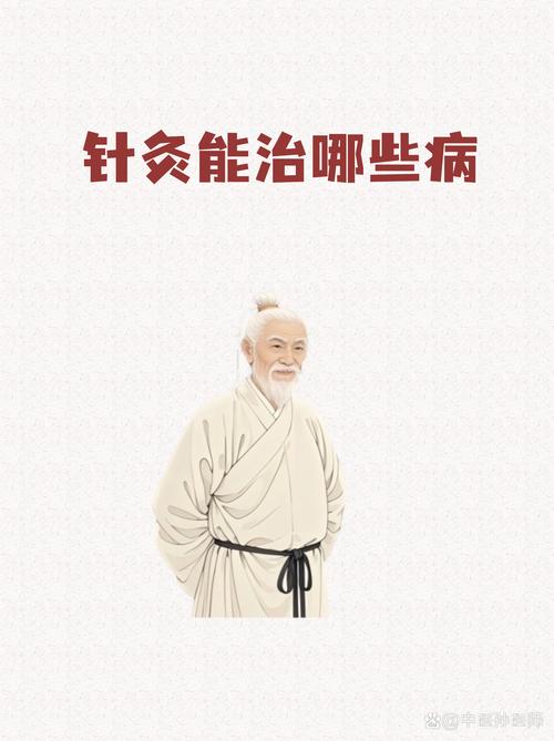 针灸能治疗慢性咽炎