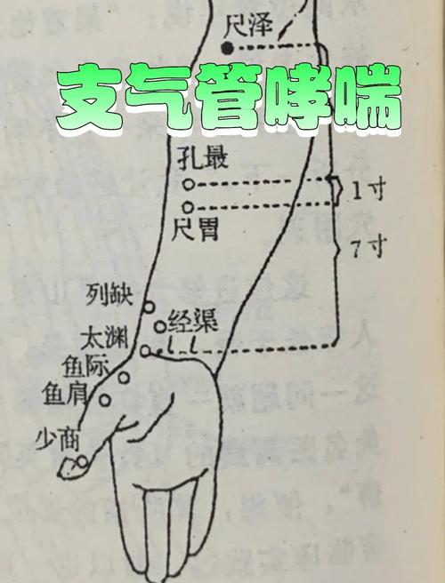 针灸可以治疗哮喘吗