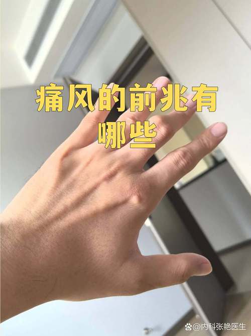 痛风前兆有什么症状