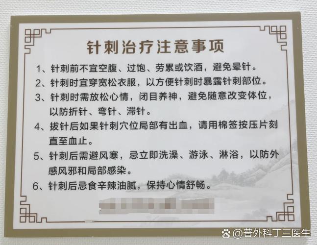 针灸可以连续扎几天