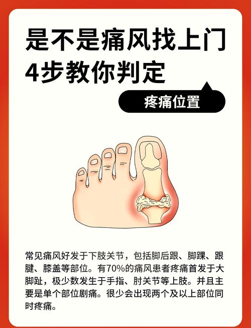 痛风要疼多久才能好