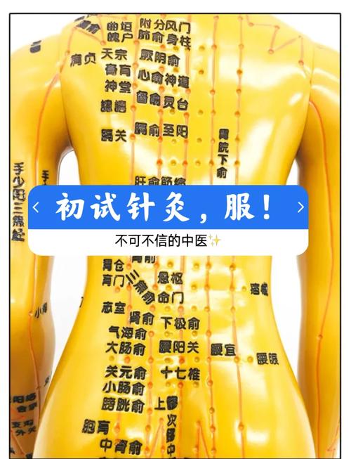 成都针灸减肥哪里好