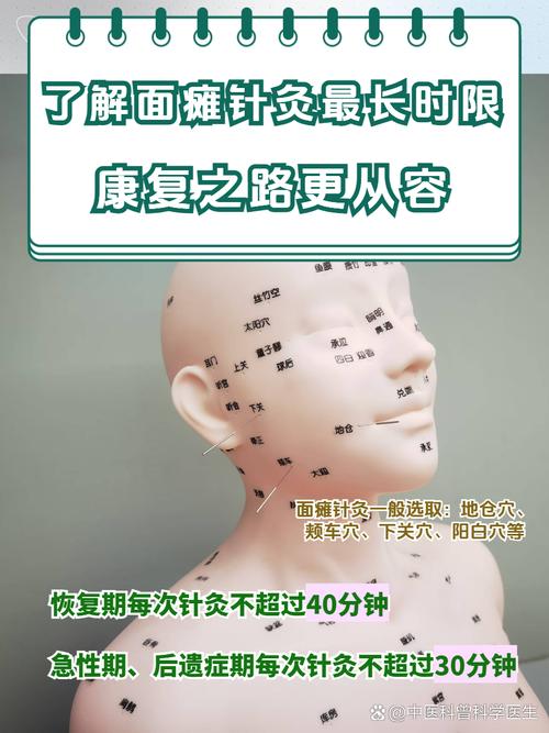 面瘫针灸多久能治好