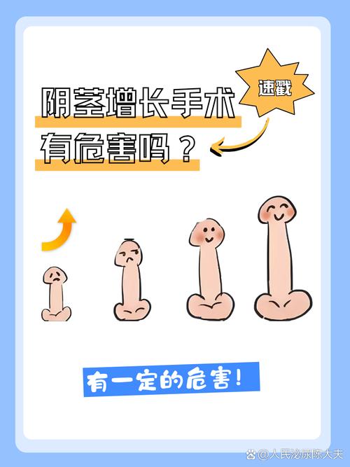 做阴茎延长手术安全吗