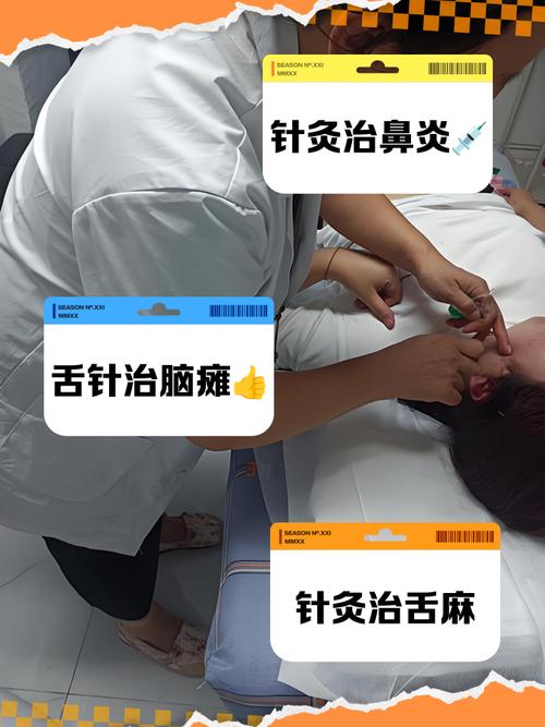 声音嘶哑怎样打针灸