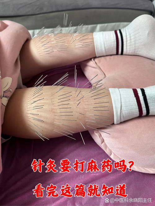 声音嘶哑怎样打针灸