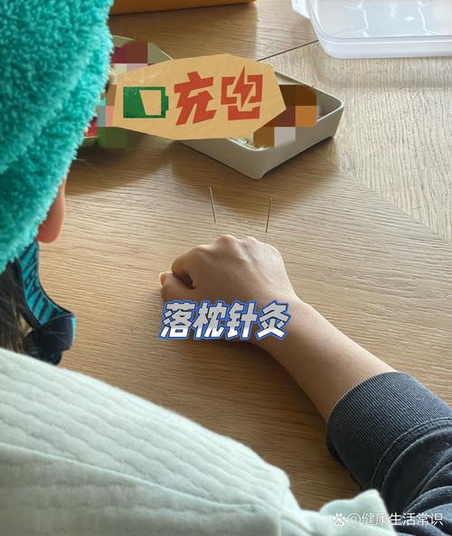 针灸治疗落枕有奇效