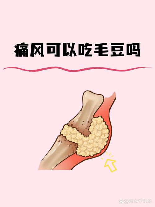 黄豆皮吃了会痛风吗